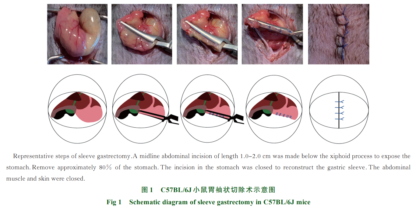 肥胖外科手術(shù)研究(圖1)