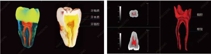 微焦點CT成像(圖5)